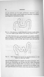 Fig. 14. Côlon transverse / Fig. 15. Côlon transverse en M renversé - Concours pour l'agrégation, se [...]