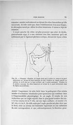Fig. 22. Colopexie - Concours pour l'agrégation, section de chirurgie et d'accouchements, exposé des [...]
