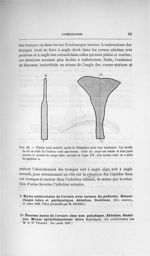 Fig. 29. Utérus avec métrite après la dilatation avec une laminaire - Concours pour l'agrégation, se [...]