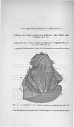 Fig. 34. Anomalie de la veine jugulaire antérieure superficielle du côté droit - Concours pour l'agr [...]