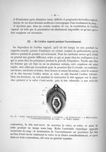 Fig. 11. Orifice vaginal avant l'accouchement - Titres et travaux scientifiques