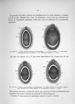 Fig. 12 et 13. Orifice vaginal pendant l'accouchement / Fig. 14 et 15. Orifice vaginal pendant l'acc [...]