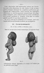 Fig. 4 - Titres et travaux scientifiques du Dr Jean Andérodias, ..., agrégation de chirurgie, sectio [...]