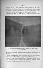 Fig. 5. Endodiagraphie de la symphyse pubienne d'un bassin oblique ovalaire acquis - Titres scientif [...]