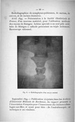 Fig. 6. Endodiagraphie d'un coccyx normal - Titres scientifiques du Dr L. Bouchacourt, agrégation de [...]