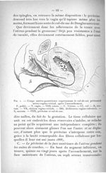 Fig. 1. Coupe antéro-postérieure représentant le cul-de-sac péritonéal utéro-vagino-vésical, après l [...]