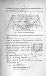 Fig. 9. Calque du cliché radiographique / Fig. 10. Mise au carreau du cliché radiographique sur papi [...]