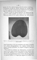 Fig. 15. Radiographie d'une lame de zinc placée obliquement par rapport à la surface sensible - Titr [...]
