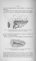 Fig. 2. Travées osseuses épaissies dont la partie marginale, acalcaire, contient des ostéoplastes no [...]