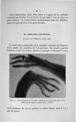 Fig. 9. Radiographie de la mère - Concours d'agrégation de chirurgie et d'accouchements, 1901, titre [...]