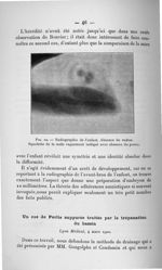 Fig. 10. Radiographie de l'enfant - Concours d'agrégation de chirurgie et d'accouchements, 1901, tit [...]