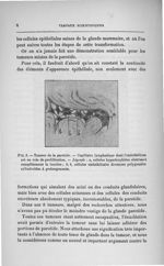 Fig. 3. Tumeur de la parotide - Concours d'agrégation de chirurgie et d'accouchements, 1901, exposé  [...]