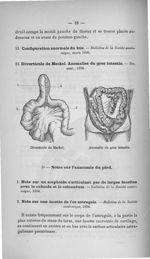 Diverticule de Meckel / Anomalie du gros intestin - Titres et travaux
