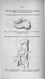 Fig. 1. L.F.P. Gouttière du long fléchisseur propre / Fig. 2. a. Apophyse trochléaire. a'. Surface d [...]