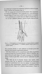 Fig. 5. 1. Filet étendu de la branche palmaire à la branche dorsale en passant à travers le cubital  [...]