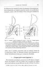Fig. 9. Intestin avant la migration du caecum - Concours pour l'agrégation, section de chirurgie et  [...]