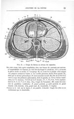 Fig. 11. Coupe du thorax au niveau du mamelon - Concours pour l'agrégation, section de chirurgie et  [...]
