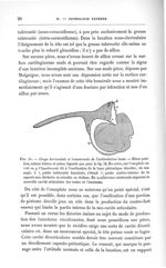 Fig. 15. Coupe horizontale et transversale de l'articulation luxée - Concours pour l'agrégation, sec [...]