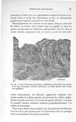 Fig. 28. Coupe d'ulcération tuberculeuse - Concours pour l'agrégation, section de chirurgie et d'acc [...]