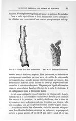 Fig. 35. Villosité de la môle hydatiforme / Fig. 36. Pointe d'accroissement - Concours pour l'agréga [...]