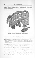 Fig. 37. Sarcome embryonnaire des villosités choriales - Concours pour l'agrégation, section de chir [...]