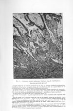 Fig. 8. Grossesse tubaire isthmique. Embryon long de 5 millimètres - Exposé des travaux