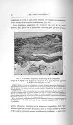 Fig. 9. Grossesse ampullaire. Foetus long de 35 millimètres - Exposé des travaux