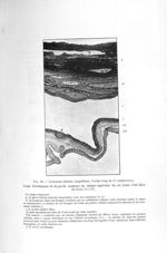 Fig. 10. Grossesse tubaire ampullaire. Foetus long de 13 centimètres - Exposé des travaux
