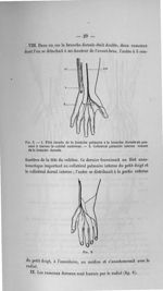 Fig. 5. 1. Filet étendu de la branche palmaire à la branche dorsale en passant à travers le cubital  [...]