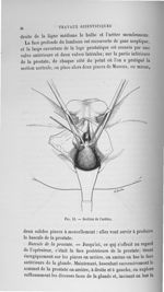 Fig. 12. Section de l'urètre - Titres et travaux