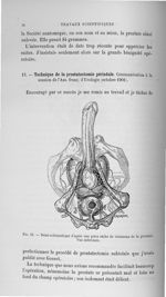 Fig. 15. Demi-schématique d'après une pièce sèche de vaisseaux de la prostate. Vue inférieure - Titr [...]