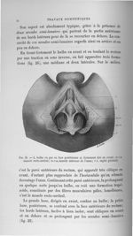 Fig. 25. b, bulbe vu par sa face postérieure et fortement tiré en avant ; m.r.u, muscle retro-urétra [...]