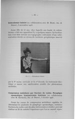 Fig. 6. Sclérodermie linéaire - Exposé des travaux scientifiques. Décembre 1903