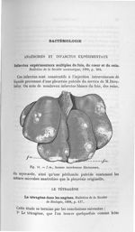 Fig. 11. f.m., fausses membranes fibrineuses - Concours d'agrégation 1904. Exposé des titres & trava [...]