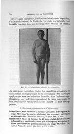 Fig. 27. Infantilisme, obésité, cryptorchidie - Concours d'agrégation 1904. Exposé des titres & trav [...]