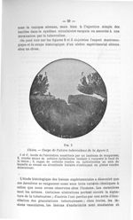 Fig. 3. Chien - Coupe de l'ulcère tuberculeux de la figure 2 - Concours pour l'agrégation, 1903, sec [...]