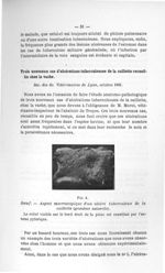 Fig. 4. Boeuf - Aspect macroscopique d'un ulcère tuberculeux de la caillette (grandeur naturelle) -  [...]