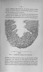 Fig. 18. Intestin d'un typhique, fixé à l'état frais - Titres et travaux scientifiques