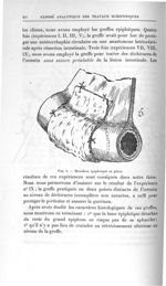 Fig. 4. Manchon épiploïque en place - Exposé des titres et travaux scientifiques