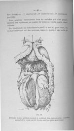 Fig. 18. Prostate, vessie, uréthres normal et artificiel d'un cystostomisé - Titres et travaux scien [...]