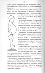 Fig. 23. (D'après Griffith). Distension abdominale - Titres et travaux scientifiques