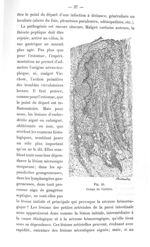 Fig. 26. Coupe de l'artère - Titres et travaux scientifiques