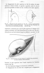 Fig. 45'. Rapports du pôle supérieur du rein droit et de la veine cave. Vue postérieure / Fig. 45''. [...]