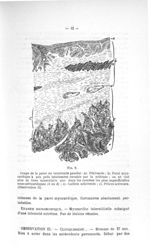 Fig. 2. Coupe de la paroi du ventricule gauche - Concours pour l'agrégation, 1904, section de pathol [...]