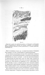 Fig. 3. Coupe de la paroi du ventricule gauche - Concours pour l'agrégation, 1904, section de pathol [...]