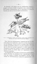 Fig. 9. Anastomose au bouton de M. Jaboulay. Premier temps, préparatoire à l'introduction de la pièc [...]