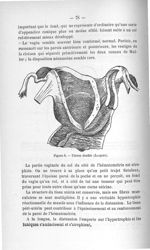 Figure 8. Utérus double (Jacquet) - Exposé des titres et travaux