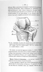Fig. 30. Articulation du genou d'un nouveau-né - Concours pour l'agrégation, 1904, section d'anatomi [...]