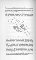 Fig. 3 - Concours d'agrégation des facultés de médecine, 1904, section de chirurgie et d'accouchemen [...]