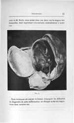 Fig. 4 - Concours d'agrégation des facultés de médecine, 1904, section de chirurgie et d'accouchemen [...]